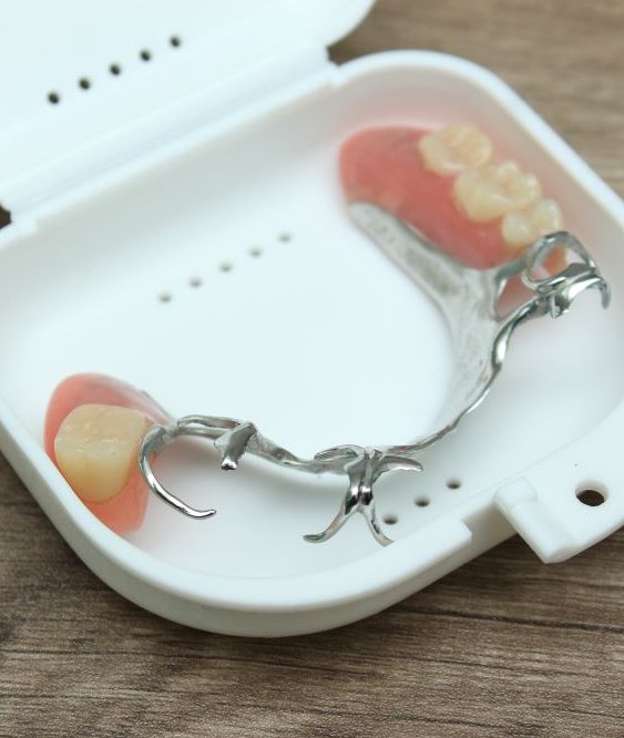 prótesis dentales sin implantes