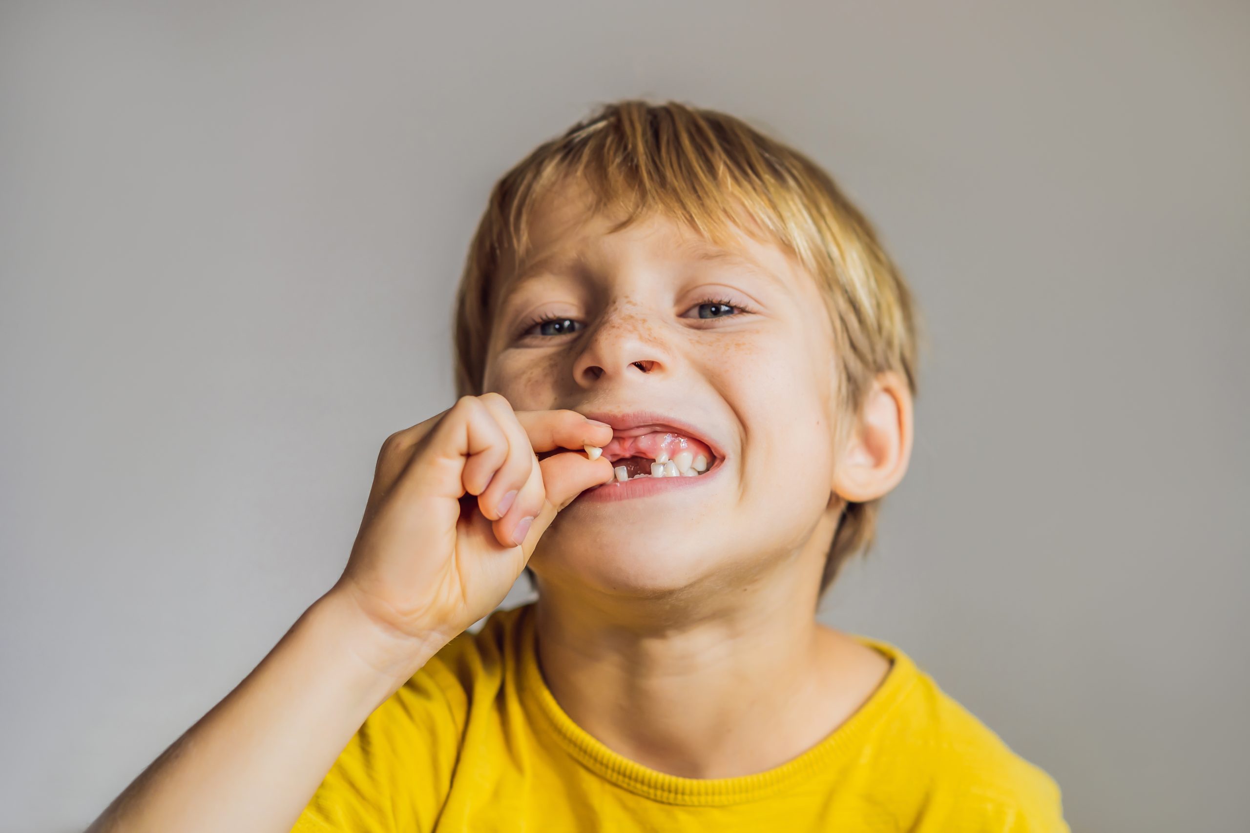 dientes de leche